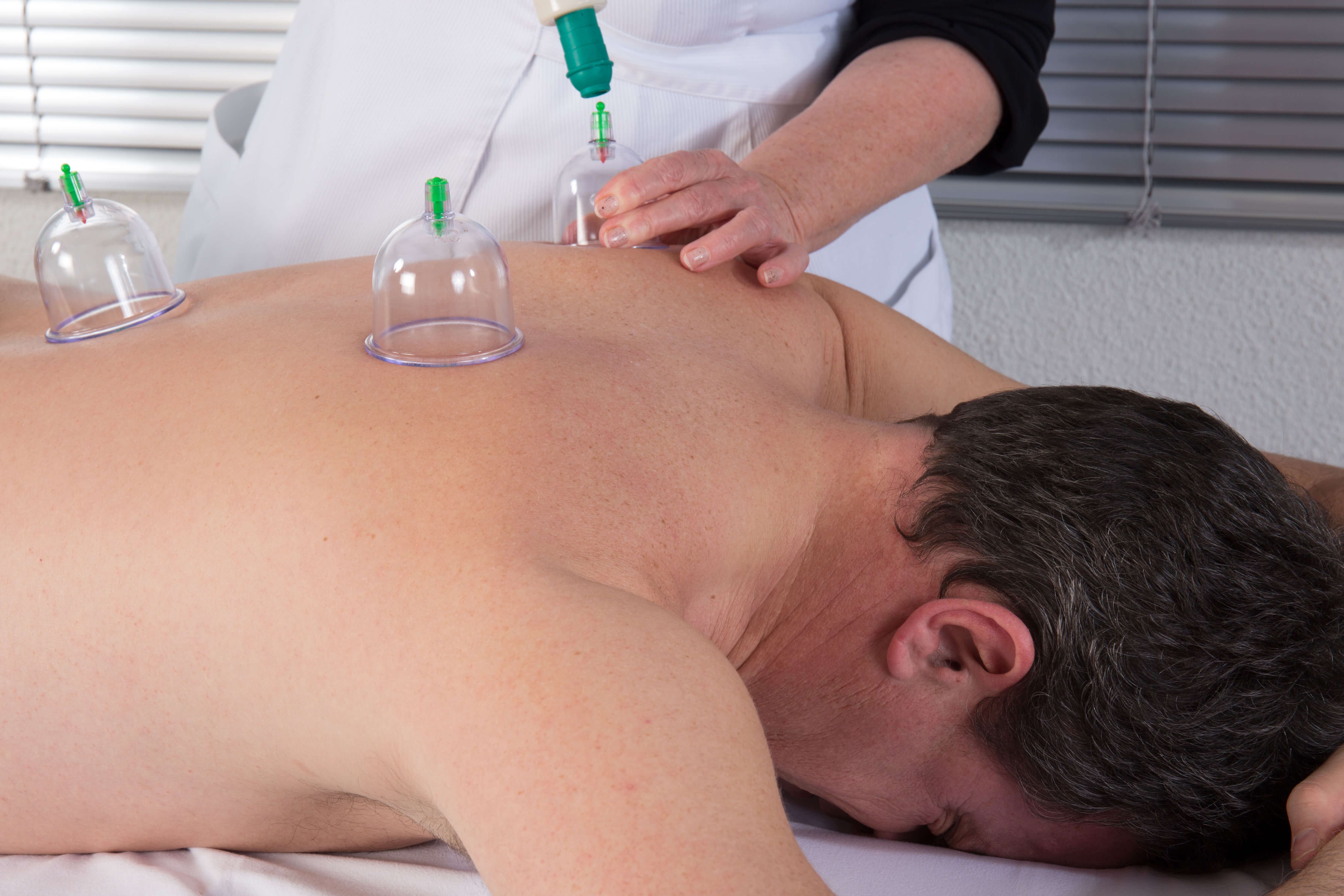 Hijama: It’s benefits and How is it Used?